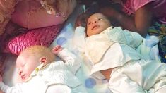 Une maman donne naissance à de rares jumeaux couleurs différentes de peau  – un à la peau noire et l’autre à la peau blanche