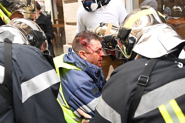  Olivier Béziade, pompier volontaire touché à la tête par un tir de LBD40 lors d'une manifestation "Gilets jaunes" à Bordeaux. (Photo : MEHDI FEDOUACH/AFP via Getty Images)