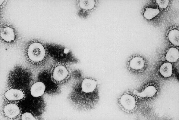 Cette photo non datée du Centre de contrôle des maladies d’Atlanta montre une vue microscopique du coronavirus au CDC d'Atlanta, en Géorgie. Photo par CDC / Getty Images.