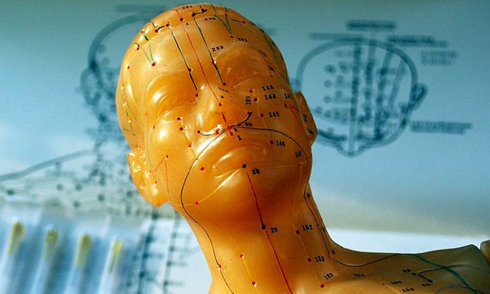 Les acupuncteurs doivent être capables de voir le corps à travers des " lunettes quantiques " afin de comprendre cet ancien système de traitement. (Crédit Cat Rooney/ The EpochTimes)