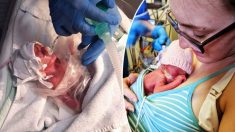 Un bébé prématuré né 4 mois plus tôt survit à un pronostic de 48 heures