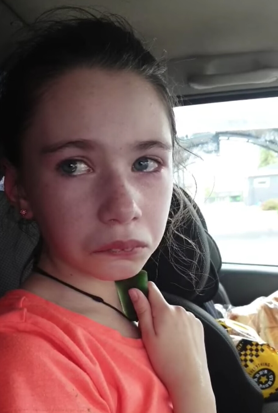 Une mère partage la vidéo émouvante de sa fille handicapée de 12 ans,  sauvagement mordue par un camarade de classe