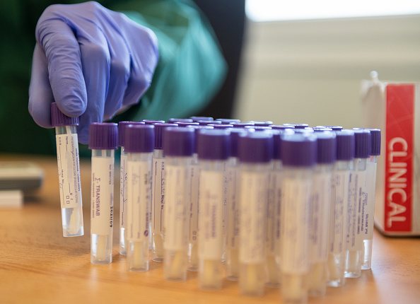 Une cinquantaine de personnes par jour viennent subir un test de dépistage du coronavirus et de la maladie causée par le virus, à Papenburg, en Allemagne.(Photo : David Hecker/Getty Images)