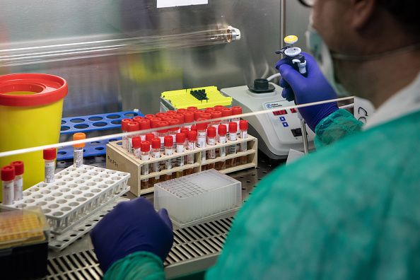 -Un employé de laboratoire tente d'isoler la présence de coronavirus au cours d'un processus de test sur écouvillon dans le laboratoire de biologie moléculaire de l'Ospedale Niguarda, le 05 mars 2020 à Milan, en Italie. Photo par Emanuele Cremaschi / Getty Images.
