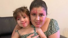 Une mère peint son visage en reproduisant les taches de naissance du visage de son enfant: «Je voulais être aussi belle qu’elle»