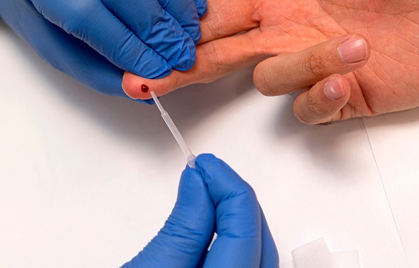 -Une personne subit un prélèvement sanguin par piqûre au doigt dans le cadre d'un test sérologique rapide pour la détection de COVID-19 le 6 mai 2020 à l'hôpital Tor Vergata Covid de Rome. Photo de Tiziana FABI / AFP via Getty Images.