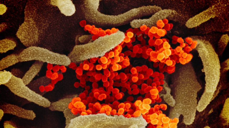 Cette image de microscope électronique à balayage montre le nouveau coronavirus (orange), qui provoque la maladie Covid-19, isolé chez un patient aux États-Unis, émergeant de la surface de cellules (vertes) cultivées en laboratoire. Photo publiée le 13 février 2020. (NIAID-RML)
