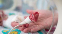 Un bébé miracle né 14 semaines avant terme défie toutes les prévisions, il respire tout seul 260 jours plus tard