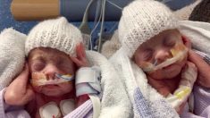 Des jumeaux miraculés nés à 24 semaines ont vaincu les probabilités de survie et sont maintenant des enfants en pleine croissance