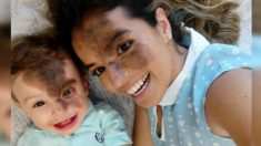 Une mère se peint le visage pour aider son fils, ayant une tache de naissance « à cause d’un baiser de Dieu », à avoir confiance en lui