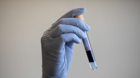Virus du PCC : les pharmacies autorisées à réaliser des tests sérologiques rapides