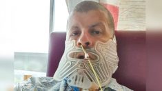 Un homme qui n’était pas allé chez le dentiste depuis 27 ans a perdu sa mâchoire après le diagnostic d’une tumeur de la taille d’un poing