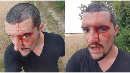 Yvelines : il fait son jogging dans les bois et se fait lacérer le crâne par une buse à deux reprises