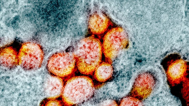 Micrographie électronique en transmission de particules du virus SRAS-CoV-2, isolées sur un patient. Image capturée et colorée à l'installation de recherche intégrée (IRF) du NIAID à Fort Detrick, Maryland (États-Unis). (NIAID)