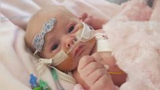 Une petite fille née avec une rare malformation cardiaque réussit à survivre à deux opérations majeures et s’apprête à avoir 3 ans
