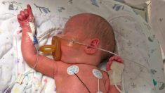 Un bébé né avec le petit intestin hors de son corps subit une intervention chirurgicale réussie
