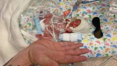 Un bébé né plus petit que la main de son père, avec 10 % de probabilité de survie, rentre à la maison