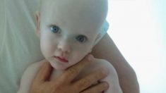 Un bébé maltraité qui « ressemblait à un extraterrestre » s’épanouit dans une famille adoptive aimante