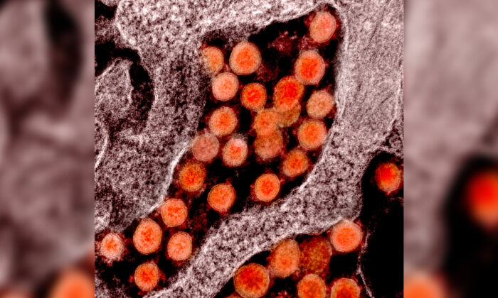 Micrographie électronique à transmission de particules du virus du PCC, ou virus du SRAS-CoV-2, isolées sur un patient (NIAID/CC PAR 2,0)