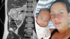 Un bébé sauve la vie de sa mère quand des médecins découvre une tumeur de la taille d’une clémentine pendant sa grossesse