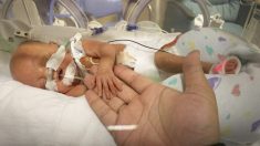 Un bébé né prématurément à 4 mois du terme rentre enfin à la maison après un an dans une unité néonatale de soins intensif