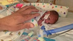 Un bébé prématuré de 454 g, né à 22 semaines, rentre chez lui après 133 jours à l’USIN