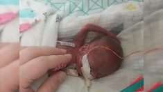 Un bébé né à 21 semaines défie les probabilités et devient l’un des plus jeunes bébés à survivre