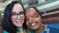 Une adolescente avec une différence faciale était presque sortie de l’âge de l’adoption, jusqu’à ce que sa mère adoptive arrive pour la ramener à la maison