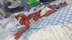 Un « bébé miracle » né à 23 semaines, alors que maman pensait qu’elle faisait une fausse couche