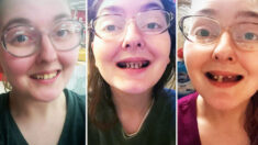 Une femme partage des photos effrayantes de caries dentaires survenues après trois ans de consommation de boissons gazeuses et d’absence de brossage