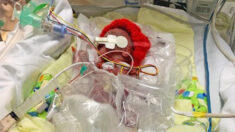 Un prématuré « miracle », pesant 538 grammes à la naissance, a survécu et a maintenant 9 mois
