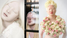 Une jeune fille albinos abandonnée par ses parents en Chine connaît une nouvelle vie et devient mannequin pour adolescents