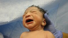 États-Unis: le visage d’un nouveau-né entaillé après une césarienne