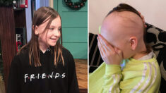 Une mère capture le triste moment où sa fille perd la moitié de ses cheveux à cause de l’alopécie