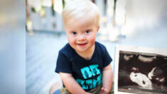 Une mère qui a refusé d’avorter d’un bébé atteint du trisomie déclare : « Il a fait de moi une meilleure personne »