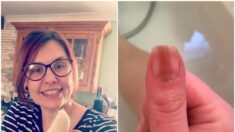 Une femme découvre un cancer mortel après avoir lu un article au sujet d’une ligne minuscule sur son ongle