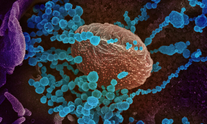 Une image au microscope électronique montre le virus de Wuhan (objets ronds bleus) – le virus qui a déclenché la pandémie du Covid-19 – émergeant de la surface de cellules cultivées en laboratoire. (NIAID-RML)