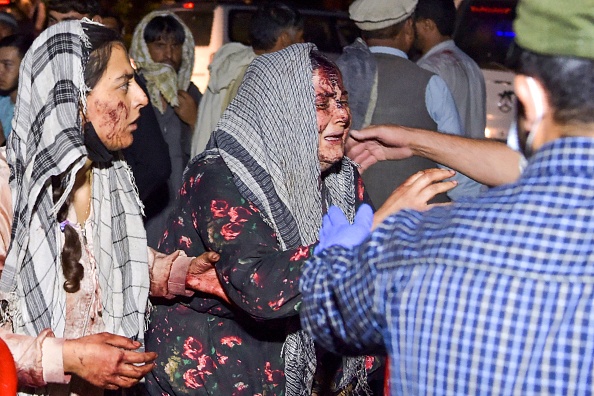 Des femmes blessées arrivent dans un hôpital pour y être soignées. (Photo : WAKIL KOHSAR/AFP via Getty Images)
