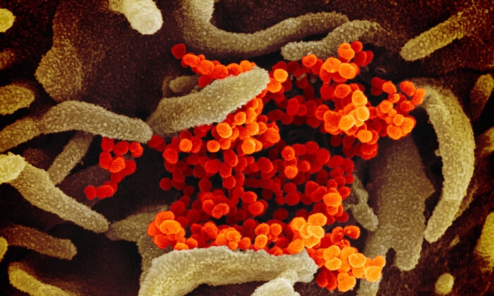 Cette image prise au microscope électronique à balayage montre le virus du PCC (orange), responsable du Covid-19, isolé chez un patient aux États-Unis, émergeant de la surface de cellules (vertes) cultivées en laboratoire. Photo publiée le 13 février 2020. (NIAID-RML)