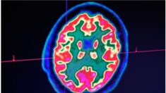 Des scientifiques affirment avoir découvert la cause de la maladie d’Alzheimer