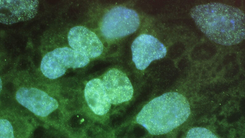 Cellules souches embryonnaires sur un écran d'ordinateur (Photo par Spencer Platt/Getty Images)