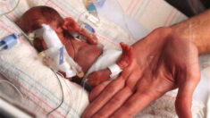 Un bébé micro-prématuré de 500 grammes défie toutes les probabilités de survie : « Miraculeux »