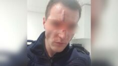 Nord : en intervention, un policier reçoit un violent coup de tête au visage
