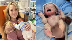 Une mère sous le choc en voyant son bébé né avec des organes hors de son corps en raison d’une maladie rare. Aujourd’hui, le petit va bien