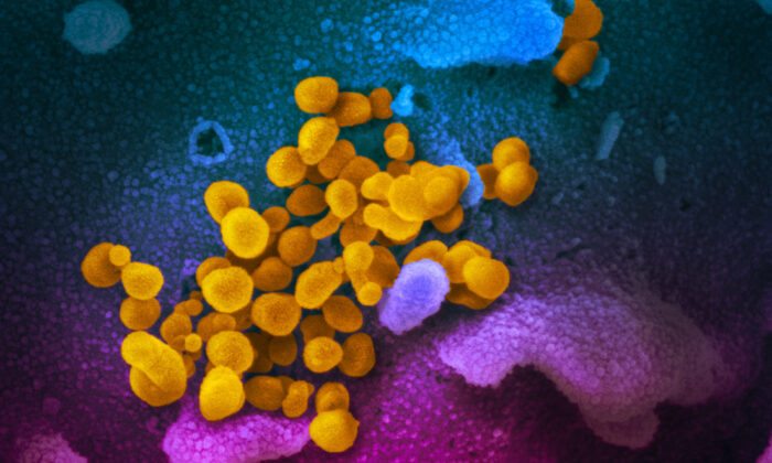 Cette image de microscope électronique non datée montre le SARS-CoV-2, en jaune, émergeant de la surface de cellules, en bleu/rose, cultivées dans un laboratoire. (Avec l'aimable autorisation du NIAID-RML)