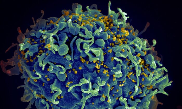 Le virus de l'immunodéficience humaine (jaune) infectant une cellule humaine. (National Cancer institute/Unsplash)