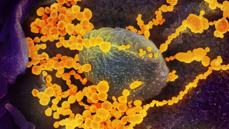 Une image au microscope électronique montre le SARS-CoV-2 (points ronds et dorés) émergeant de cellules en culture. (NIAID)