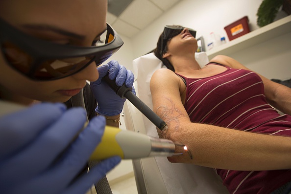 Le détatouage au laser est un acte médical . C'est la seule manière vraiment efficace et sécuritaire d'enlever un tatouage. (DAVID MCNEW/AFP via Getty Images)
