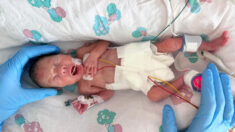 Une mère dit que son bébé né 14 semaines en avance est un «vrai miracle et la perfection même»