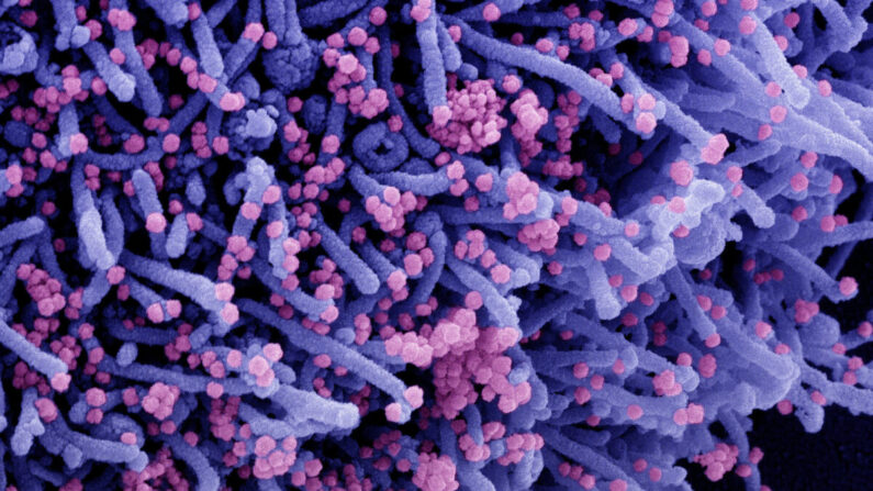 Micrographie électronique à balayage colorisée d'une cellule (en violet) infectée par une souche de particules virales variantes du SRAS-CoV-2 (en rose) (NIAID via Epoch Times)
